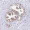 Actin Related Protein 3C antibody, NBP2-49206, Novus Biologicals, Immunohistochemistry paraffin image 