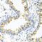 Heat Shock Protein Family A (Hsp70) Member 6 antibody, 23-108, ProSci, Immunohistochemistry frozen image 