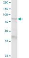 Transglutaminase 1 antibody, H00007051-D01P, Novus Biologicals, Western Blot image 