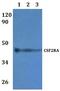 Colony Stimulating Factor 2 Receptor Alpha Subunit antibody, A04432-2, Boster Biological Technology, Western Blot image 