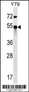 ZFP14 Zinc Finger Protein antibody, 56-282, ProSci, Western Blot image 
