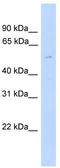 Tubulin Gamma 2 antibody, TA333777, Origene, Western Blot image 