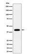 Short-chain specific acyl-CoA dehydrogenase, mitochondrial antibody, M05028-1, Boster Biological Technology, Western Blot image 