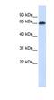 Frizzled Class Receptor 4 antibody, orb330168, Biorbyt, Western Blot image 