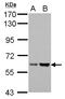 Asparagine Synthetase (Glutamine-Hydrolyzing) antibody, GTX114269, GeneTex, Western Blot image 