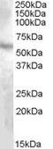 Transmembrane protease serine 4 antibody, 46-909, ProSci, Western Blot image 