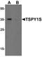 Testis Specific Protein Y-Linked 1 antibody, PA5-34484, Invitrogen Antibodies, Western Blot image 