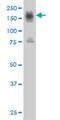 CD49D antibody, H00003676-M01, Novus Biologicals, Western Blot image 