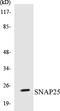 Synaptosome Associated Protein 25 antibody, EKC1533, Boster Biological Technology, Western Blot image 