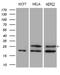 Methyltransferase Like 7A antibody, M14279, Boster Biological Technology, Western Blot image 