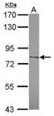 Carboxypeptidase X, M14 Family Member 2 antibody, GTX119255, GeneTex, Western Blot image 