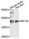 Melanocortin 1 Receptor antibody, LS-C748560, Lifespan Biosciences, Western Blot image 