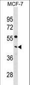 Phosphate Cytidylyltransferase 1, Choline, Alpha antibody, LS-C158036, Lifespan Biosciences, Western Blot image 