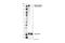 TSC Complex Subunit 2 antibody, 23402S, Cell Signaling Technology, Western Blot image 