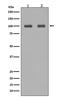 Aconitase 1 antibody, M02781, Boster Biological Technology, Western Blot image 