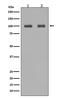 IRP1 antibody, M02781, Boster Biological Technology, Western Blot image 