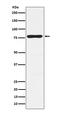 Protein Kinase C Gamma antibody, M01890-2, Boster Biological Technology, Western Blot image 