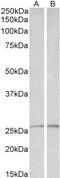 Syndecan 1 antibody, 43-488, ProSci, Western Blot image 