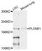 Plexin B1 antibody, LS-B15575, Lifespan Biosciences, Western Blot image 
