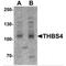 Thrombospondin 4 antibody, MBS150877, MyBioSource, Western Blot image 