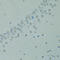 Cancer/Testis Antigen 1B antibody, 23-915, ProSci, Immunohistochemistry paraffin image 