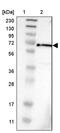 Potassium Voltage-Gated Channel Subfamily A Member 6 antibody, PA5-53163, Invitrogen Antibodies, Western Blot image 