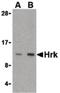 Harakiri, BCL2 Interacting Protein antibody, PA5-20235, Invitrogen Antibodies, Western Blot image 