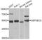 Sep (O-phosphoserine) tRNA:Sec (Selenocysteine) tRNA synthase antibody, A05769, Boster Biological Technology, Western Blot image 