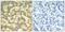 Spleen Associated Tyrosine Kinase antibody, PA5-37746, Invitrogen Antibodies, Immunohistochemistry paraffin image 