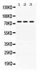 Acsl2 antibody, LS-C662313, Lifespan Biosciences, Western Blot image 