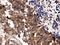Polo Like Kinase 1 antibody, PB9500, Boster Biological Technology, Immunohistochemistry frozen image 