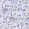 Apurinic/Apyrimidinic Endodeoxyribonuclease 1 antibody, A1117, ABclonal Technology, Immunohistochemistry paraffin image 