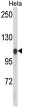 Heat Shock Protein Family A (Hsp70) Member 4 Like antibody, AP18058PU-N, Origene, Western Blot image 