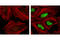 Checkpoint Kinase 2 antibody, 2661L, Cell Signaling Technology, Immunocytochemistry image 