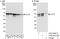 Chaperonin Containing TCP1 Subunit 5 antibody, A303-480A, Bethyl Labs, Western Blot image 