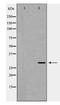 Aquaporin 1 (Colton Blood Group) antibody, TA347925, Origene, Western Blot image 