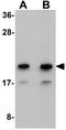 NADH:Ubiquinone Oxidoreductase Complex Assembly Factor 2 antibody, GTX85237, GeneTex, Western Blot image 