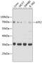 Activating Transcription Factor 2 antibody, A2155, ABclonal Technology, Western Blot image 