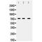 ATP Binding Cassette Subfamily G Member 5 antibody, LS-C407630, Lifespan Biosciences, Western Blot image 