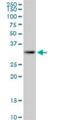 Potassium Channel Regulator antibody, H00283518-B01P, Novus Biologicals, Western Blot image 