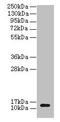 Colipase antibody, LS-C285758, Lifespan Biosciences, Western Blot image 