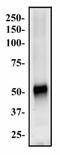 ATP Binding Cassette Subfamily G Member 8 antibody, NB400-117, Novus Biologicals, Western Blot image 