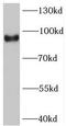 Synaptic Vesicle Glycoprotein 2C antibody, FNab08408, FineTest, Western Blot image 