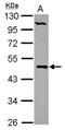 Phosphate Cytidylyltransferase 2, Ethanolamine antibody, NBP2-19735, Novus Biologicals, Western Blot image 