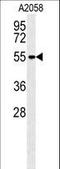 Matrix Metallopeptidase 14 antibody, LS-C164235, Lifespan Biosciences, Western Blot image 