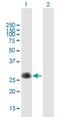 Transmembrane And Ubiquitin Like Domain Containing 1 antibody, H00083590-B01P-50ug, Novus Biologicals, Western Blot image 