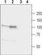 Neuroligin 1 antibody, TA328901, Origene, Western Blot image 