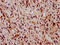 Erk1 antibody, CSB-RA013456A185phHU, Cusabio, Immunohistochemistry paraffin image 