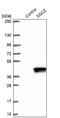 Sarcoglycan Zeta antibody, NBP2-48536, Novus Biologicals, Western Blot image 