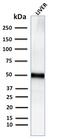 Perilipin 2 antibody, GTX02691, GeneTex, Western Blot image 